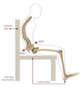 posterior pelvic tilt Seating Matters.png